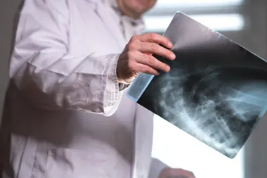 Traumatologia narządu ruchu: Kiedy warto udać się do specjalisty?